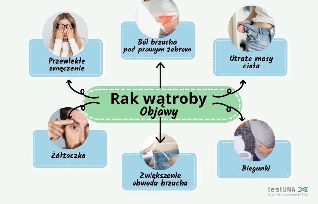 objawy raka wątroby infografika